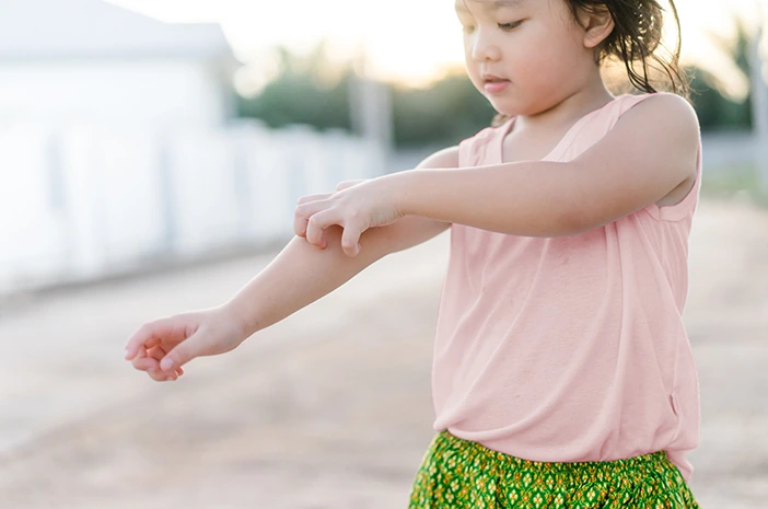 Penyebab kulit busik