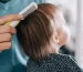 Kenapa rambut anak rontok